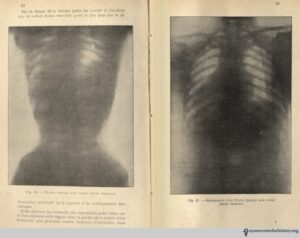 O'Followell_LeCorset-v2_1908_48-49_watermark