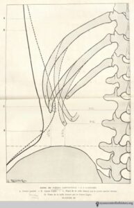 O'Followell_LeCorset-v2_1908_schema_watermark