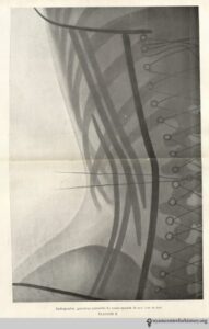 O'Followell_LeCorset-v2_1908_xray_corsetdevant_watermark