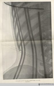 O'Followell_LeCorset-v2_1908_xray_corsetligne_watermark