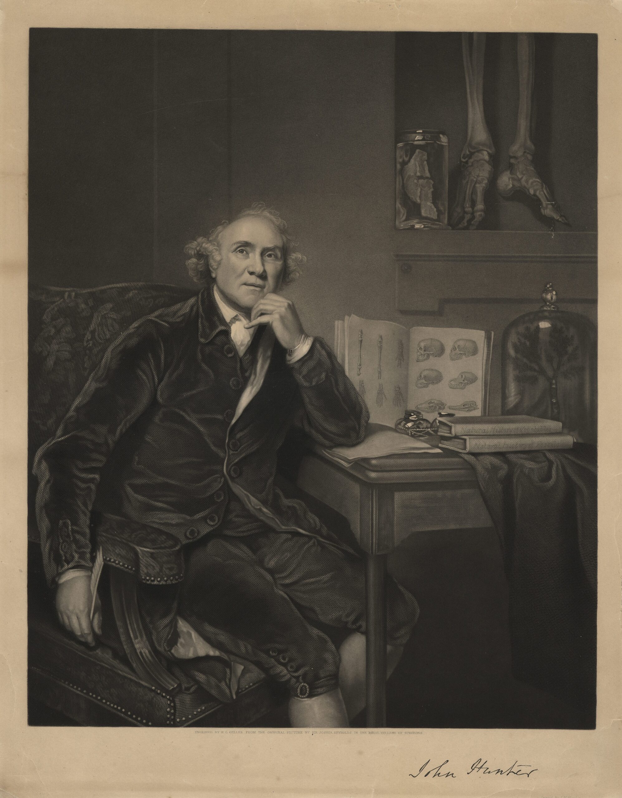 Dr. Fenwick Beekman Donates Works Related to Dr. John Hunter 